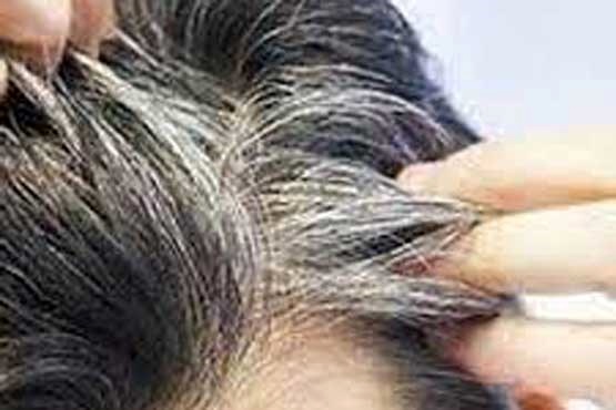 چند راهکار ساده برای دیرتر سفید شدن موهای سر